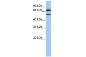 Image no. 1 for anti-F-Box Protein 7 (FBXO7) (C-Term) antibody (ABIN6740800)