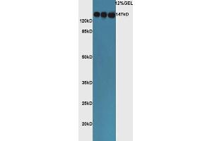 Image no. 2 for anti-Angiotensin I Converting Enzyme (Peptidyl-Dipeptidase A) 1 (ACE) (AA 801-900) antibody (ABIN668631)