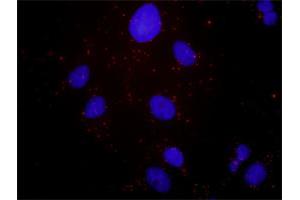 Image no. 3 for anti-Hepatocyte Growth Factor (Hepapoietin A, Scatter Factor) (HGF) (AA 1-728) antibody (ABIN516424)