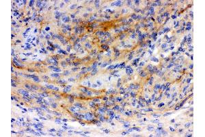 Image no. 2 for anti-Growth Associated Protein 43 (GAP43) (AA 216-238), (C-Term) antibody (ABIN3043685)
