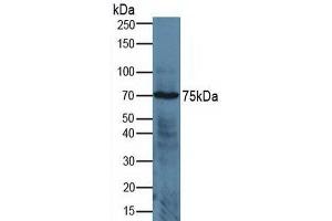 Image no. 3 for ADAM Metallopeptidase Domain 17 (ADAM17) ELISA Kit (ABIN6730919)