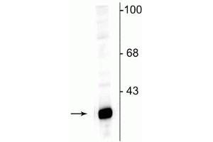 Image no. 2 for anti-Protein Phosphatase 1, Regulatory (Inhibitor) Subunit 1B (PPP1R1B) (N-Term) antibody (ABIN361423)