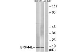 Image no. 1 for anti-Brain Protein 44-Like (BRP44L) (AA 11-60) antibody (ABIN1534701)