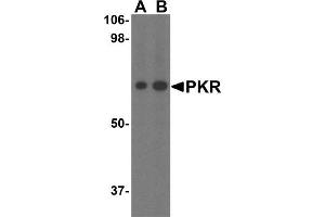 Image no. 4 for anti-Eukaryotic Translation Initiation Factor 2-alpha Kinase 2 (EIF2AK2) (N-Term) antibody (ABIN6657000)