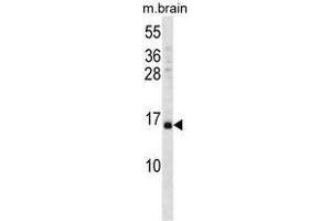 Image no. 1 for anti-Vesicle-Associated Membrane Protein 3 (VAMP3) (AA 14-43), (Middle Region) antibody (ABIN955499)