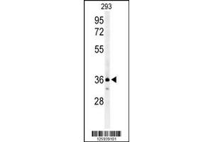 Western Blotting (WB) image for anti-Chemokine (C-C Motif) Receptor 1 (CCR1) antibody (ABIN2159861)