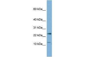 Image no. 2 for anti-Protein Phosphatase 1, Regulatory (Inhibitor) Subunit 11 (PPP1R11) (N-Term) antibody (ABIN2783353)