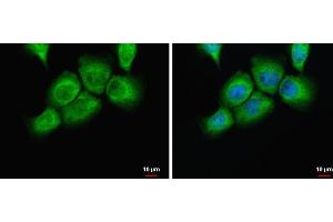 ICC/IF Image uPAR antibody detects uPAR protein at cytoplasm by immunofluorescent analysis.
