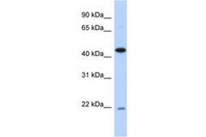 Image no. 1 for anti-RNA-Binding Protein NOB1 (NOB1) (AA 35-84) antibody (ABIN6741274)