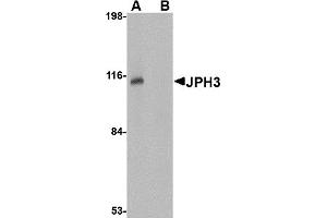 Image no. 1 for anti-Junctophilin 3 (JPH3) (Middle Region) antibody (ABIN1030970)
