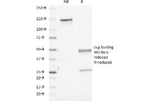 Image no. 1 for anti-TGF-beta (TGFb) antibody (ABIN6940723)