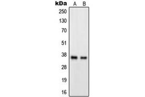 Image no. 1 for anti-G Protein-Coupled Receptor 82 (GPR82) (Center) antibody (ABIN2706274)
