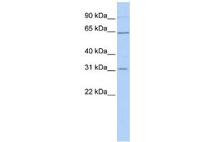 SLC27A2 抗体  (N-Term)