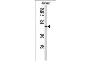 Western blot analysis of ACR Antibody in Jurkat cell line lysates (35ug/lane)