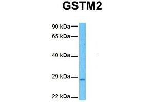 Image no. 3 for anti-Glutathione S-Transferase mu 2 (Muscle) (GSTM2) (N-Term) antibody (ABIN2777010)
