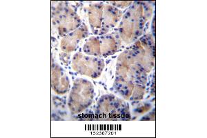 Image no. 1 for anti-Carboxylesterase 4A (CES4A) (AA 533-561), (C-Term) antibody (ABIN656888)