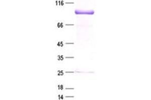 Image no. 1 for SRY (Sex Determining Region Y)-Box 5 (SOX5) protein (DYKDDDDK Tag) (ABIN2732465)