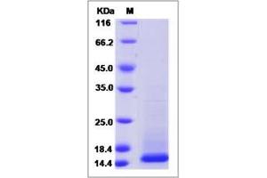 Image no. 1 for Cystatin C (CST3) (AA 1-146) protein (ABIN2002853)