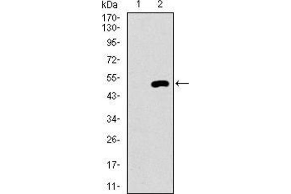 EGFR anticorps  (Mutant)
