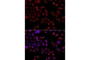 Image no. 2 for anti-Solute Carrier Family 22 (Organic Cation Transporter), Member 11 (SLC22A11) antibody (ABIN2737539)