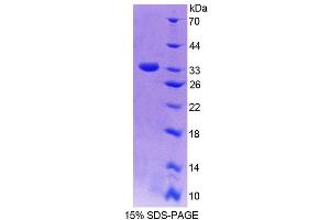 Image no. 1 for NAD(P)H Dehydrogenase, Quinone 1 (NQO1) (AA 2-273) protein (His tag) (ABIN6236473)
