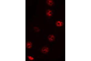 Image no. 2 for anti-Zinc Finger Protein 785 (ZNF785) antibody (ABIN6266137)