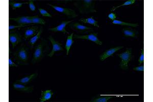 Image no. 5 for anti-Formin 1 (FMN1) (AA 1-109) antibody (ABIN949949)