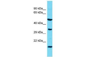 Image no. 1 for anti-Chromosome 11 Open Reading Frame 73 (C11orf73) (N-Term) antibody (ABIN2786965)