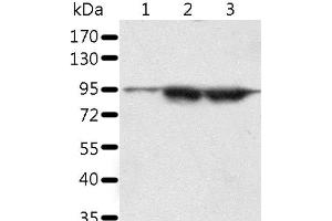 Western Blot analysis of A549 and lncap cell, Human seminoma tissue using SPATA20 Polyclonal Antibody at dilution of 1:1000