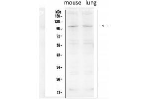Image no. 1 for anti-Transient Receptor Potential Cation Channel, Subfamily C, Member 6 (TRPC6) (AA 249-265), (Middle Region) antibody (ABIN3044146)