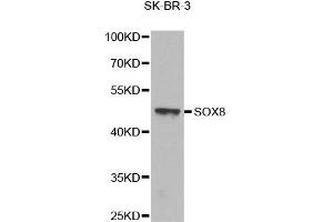 Image no. 1 for anti-SRY (Sex Determining Region Y)-Box 8 (SOX8) antibody (ABIN1874911)