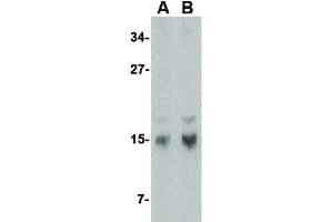 Image no. 3 for anti-Stathmin 1 (STMN1) (N-Term) antibody (ABIN6656559)