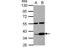 anti-Leucine Zipper Protein 4 (LUZP4) (Center) antibody