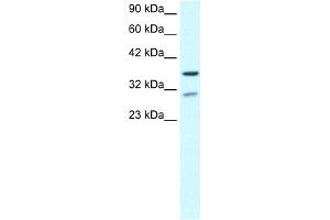 Image no. 2 for anti-Zinc Finger Protein 385A (ZNF385A) (N-Term) antibody (ABIN2779710)