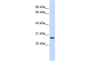 Image no. 1 for anti-LSM12 Homolog B (LSM12B) antibody (ABIN632732)