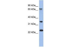 Image no. 1 for anti-TBC1 Domain Family, Member 25 (TBC1D25) (N-Term) antibody (ABIN632894)