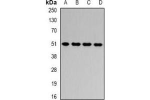 Image no. 2 for anti-Hydroxyacyl-CoA Dehydrogenase/3-Ketoacyl-CoA Thiolase/enoyl-CoA Hydratase (Trifunctional Protein), beta Subunit (HADHB) antibody (ABIN2966700)