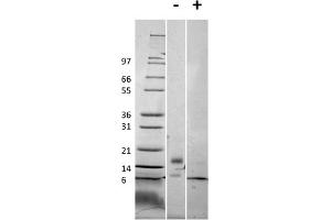 Image no. 1 for Resistin Like beta (RETNLB) protein (ABIN6700472)