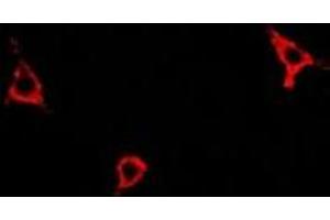 Image no. 1 for anti-Asparagine Synthetase (ASNS) antibody (ABIN2966442)