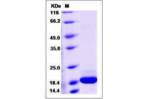 Image no. 1 for Interferon, alpha 14 (IFNa14) (AA 24-189) (Active) protein (His tag) (ABIN2008129)