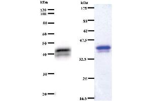 Image no. 1 for anti-Additional Sex Combs Like 1 (ASXL1) antibody (ABIN930987)