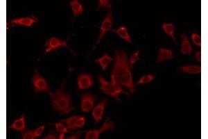 Image no. 1 for anti-Mitochondrial Import Receptor Subunit TOM20 homolog (TOMM20) antibody (ABIN6257652)