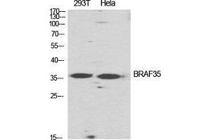 Image no. 2 for anti-High Mobility Group 20B (HMG20B) (N-Term) antibody (ABIN3183539)