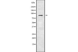 Image no. 1 for anti-ADAM Metallopeptidase Domain 30 (ADAM30) (Internal Region) antibody (ABIN6259773)