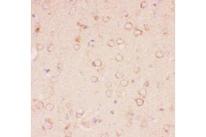 Image no. 3 for anti-Tuberous Sclerosis 2 (TSC2) (AA 1611-1807) antibody (ABIN3043498)