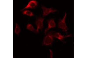 Image no. 1 for anti-Tyrosinase (TYR) antibody (ABIN6265828)