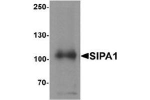 Image no. 2 for anti-Signal-Induced Proliferation-Associated 1 (SIPA1) (N-Term) antibody (ABIN1450109)
