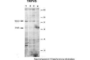 Image no. 3 for anti-Transient Receptor Potential Cation Channel, Subfamily V, Member 5 (TRPV5) (N-Term) antibody (ABIN2783755)