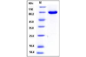 Mitogen-Activated Protein Kinase 1 (MAPK1) (AA 1-360) protein (GST tag)