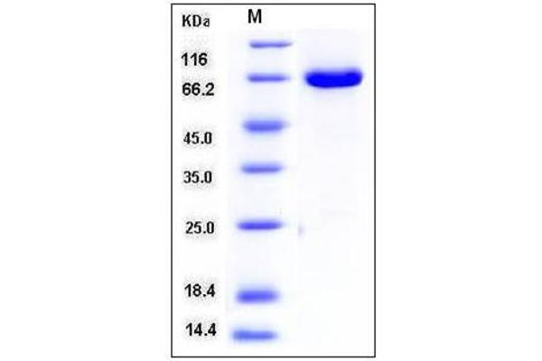 Mitogen-Activated Protein Kinase 1 (MAPK1) (AA 1-360) protein (GST tag)
